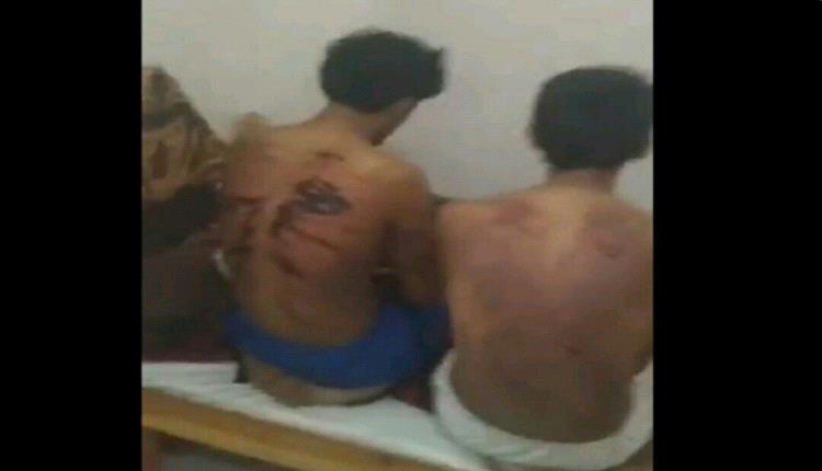إدانة رسمية وتفاصيل واقعة تعذيب ٧مواطنيين يمنيين بسلطنة عمان(صورة)